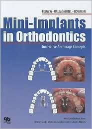 Mini Implants in Orthodontics Innovative Anchorage Concepts 