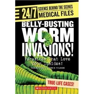  Belly Busting Worm Invasions Parasites That Love Your 