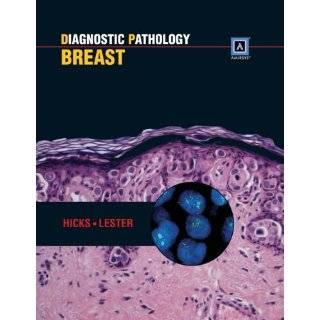 Books Breast   Cancer   Pathophysiology