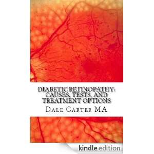 Diabetic Retinopathy Causes, Tests, and Treatment Options Dale 