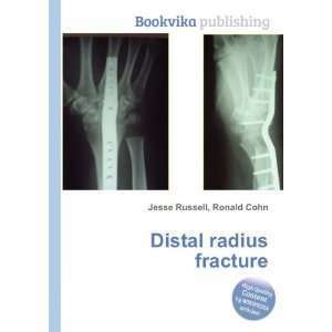  Distal radius fracture Ronald Cohn Jesse Russell Books