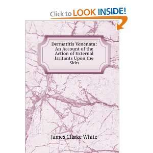   Action of External Irritants Upon the Skin James Clarke White Books