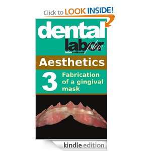 Fabrication of a gingival mask (dental lab technology articles) Dr 