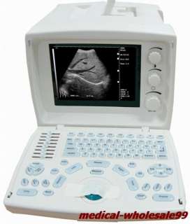 USB CE proved portable ultrasound scanner+convex probe USB port low 